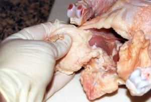 Removing fat from cavity opening
