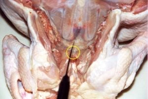 Cutting cartilage to expose top of breastbone