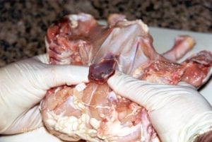 Top of breastbone popping out