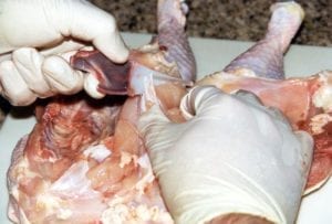 Removing the breastbone